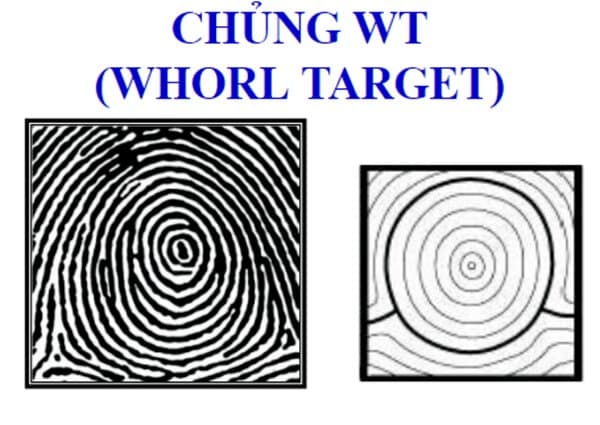 Chủng vân tay Whorl Target